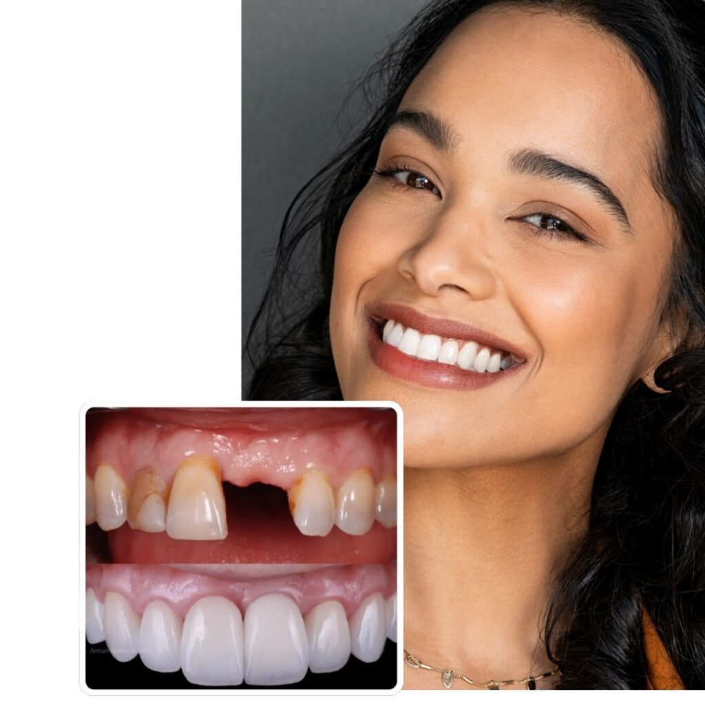 Implant consultation with 3D scan at London Dental Arts