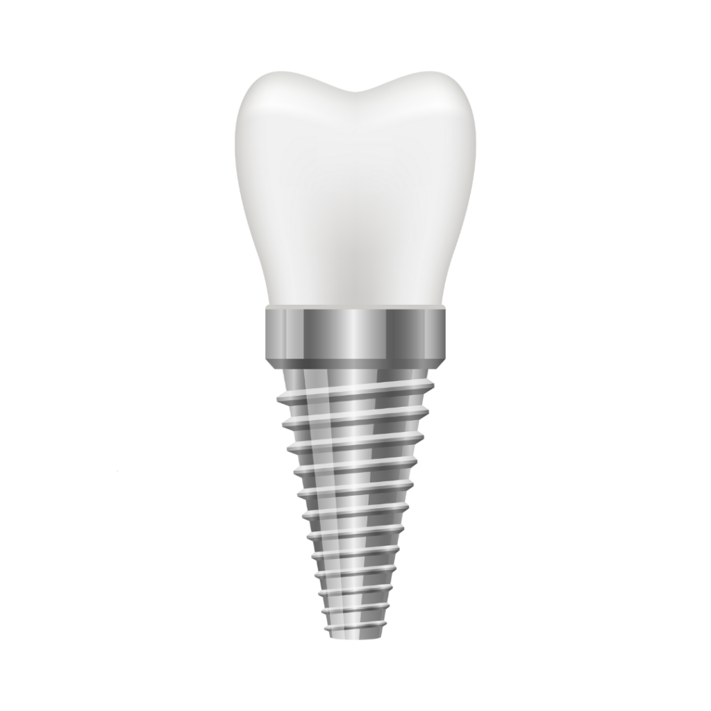 Single tooth dental implant result
