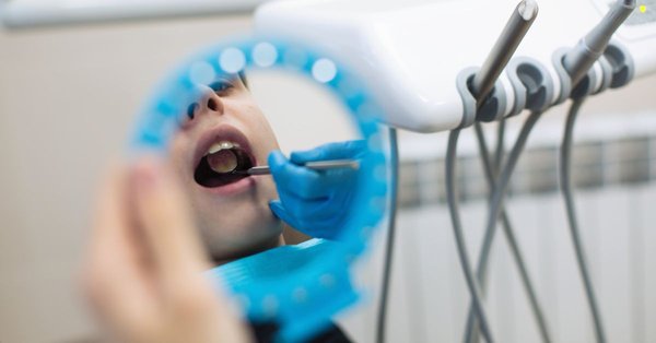Root Canal